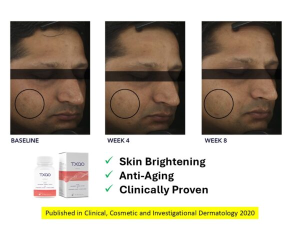 Txao: Improve your Immune System - Image 4